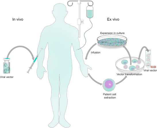 In vivo and Ex vivo viral vector delivery methods for gene therapy