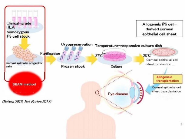 A Pioneering Leap in Regenerative Medicine: iMatrix 511 and the Future of Corneal Transplants 