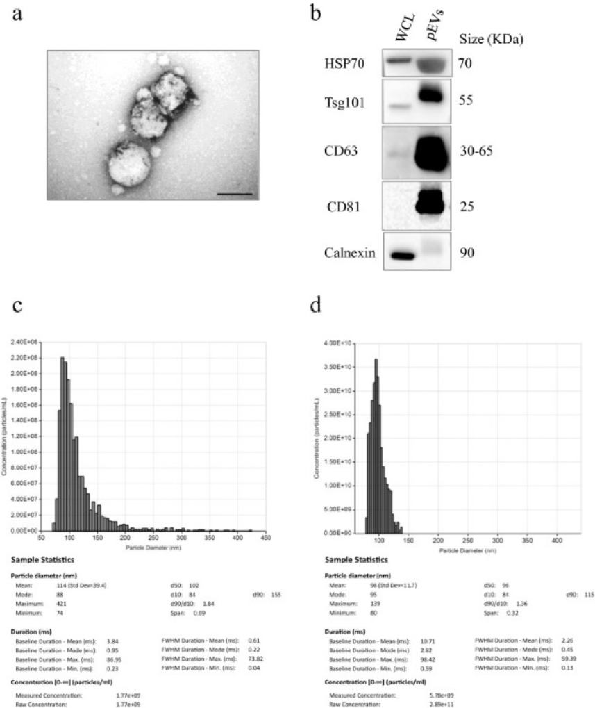 Characterization of pEVs in Melanoma Patients and Healthy Controls using Izon Exoid TRPS. 