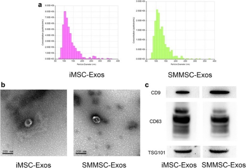 TRPS measurement showing exosome concentration and size distribution.